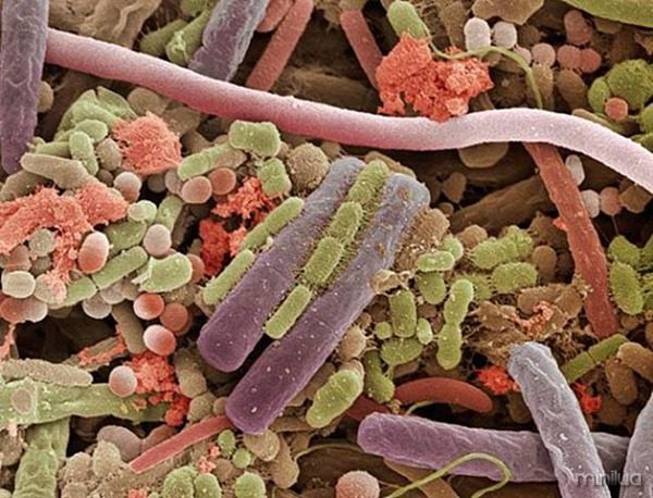 bacteria na lingua