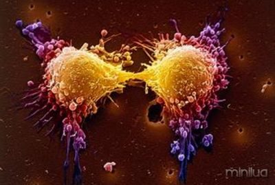 foto divisão de células cancerosas